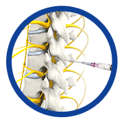 Epidural Steroid Injections