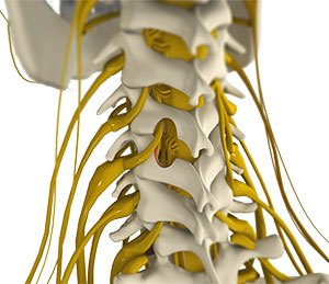 Cervical Microdiscectomy