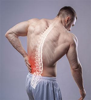 Low Back Pain 