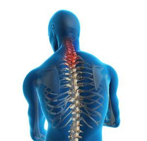 Neck Strains and Sprains 