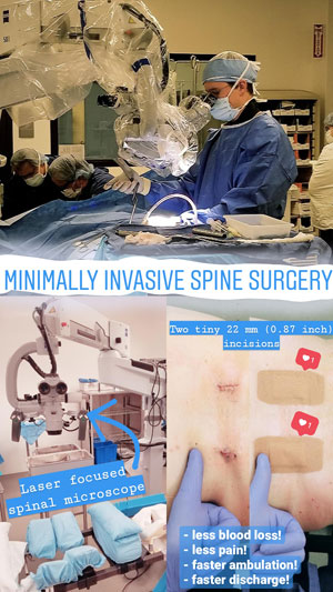 Minimally Invasive Spine Surgery Miss Dallas Tx Spine Surgery Dallas Tx