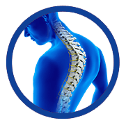 Complex Spine Deformities