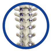 Deformity Correction